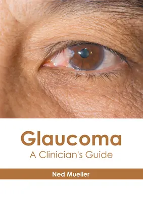 Jaskra: Przewodnik klinicysty - Glaucoma: A Clinician's Guide