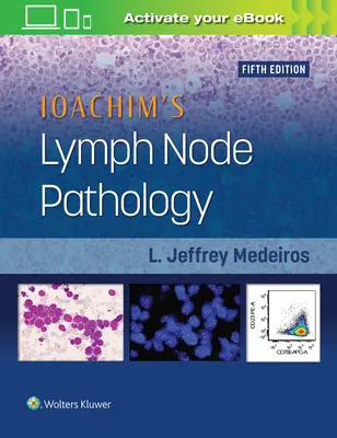 Patologia węzłów chłonnych Ioachima - Ioachim's Lymph Node Pathology