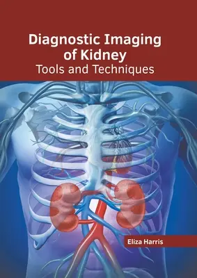 Obrazowanie diagnostyczne nerek: Narzędzia i techniki - Diagnostic Imaging of Kidney: Tools and Techniques