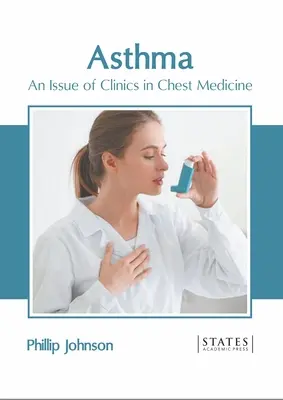 Astma: Wydanie klinik medycyny klatki piersiowej - Asthma: An Issue of Clinics in Chest Medicine