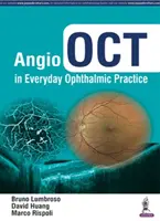 Angio Oct w codziennej praktyce okulistycznej - Angio Oct in Everyday Ophthalmic Practice