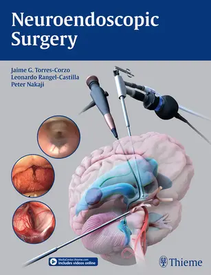 Chirurgia neuroendoskopowa - Neuroendoscopic Surgery