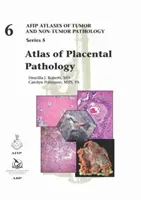 Atlas patologii łożyska - Atlas of Placental Pathology