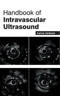 Podręcznik ultrasonografii wewnątrznaczyniowej - Handbook of Intravascular Ultrasound