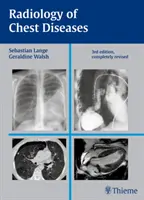 Radiologia chorób klatki piersiowej - Radiology of Chest Diseases
