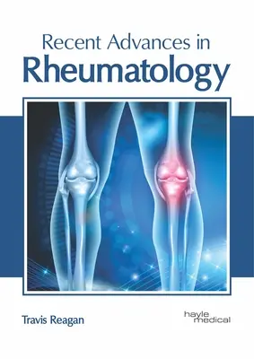 Najnowsze osiągnięcia w reumatologii - Recent Advances in Rheumatology