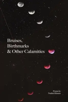 Siniaki, znamiona i inne nieszczęścia - Bruises, Birthmarks & Other Calamities