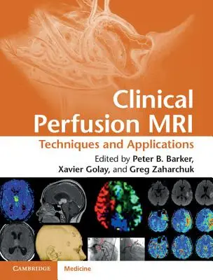 Kliniczna perfuzja rezonansu magnetycznego: Techniki i zastosowania - Clinical Perfusion MRI: Techniques and Applications