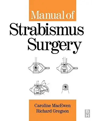 Podręcznik chirurgii zeza - Manual of Strabismus Surgery