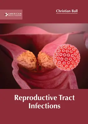 Infekcje układu rozrodczego - Reproductive Tract Infections