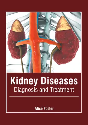 Choroby nerek: Diagnoza i leczenie - Kidney Diseases: Diagnosis and Treatment