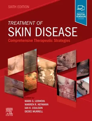 Leczenie chorób skóry: Kompleksowe strategie terapeutyczne - Treatment of Skin Disease: Comprehensive Therapeutic Strategies