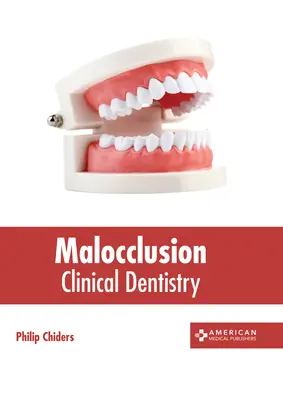 Wady zgryzu: Stomatologia kliniczna - Malocclusion: Clinical Dentistry