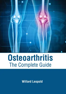 Choroba zwyrodnieniowa stawów: Kompletny przewodnik - Osteoarthritis: The Complete Guide