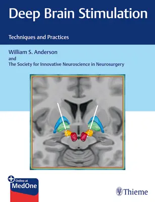 Głęboka stymulacja mózgu: Techniki i praktyki - Deep Brain Stimulation: Techniques and Practices