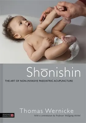 Shonishin: Sztuka nieinwazyjnej akupunktury pediatrycznej - Shonishin: The Art of Non-Invasive Paediatric Acupuncture