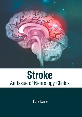 Udar mózgu: Wydanie klinik neurologicznych - Stroke: An Issue of Neurology Clinics