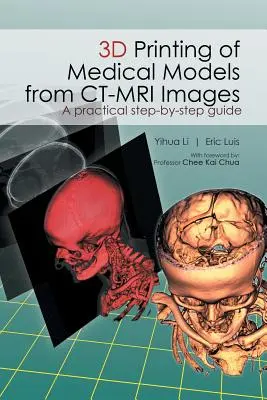 Drukowanie 3D modeli medycznych z obrazów CT-MRI: Praktyczny przewodnik krok po kroku - 3D Printing of Medical Models from CT-MRI Images: A Practical step-by-step guide