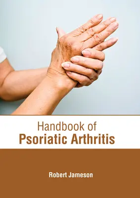 Podręcznik łuszczycowego zapalenia stawów - Handbook of Psoriatic Arthritis