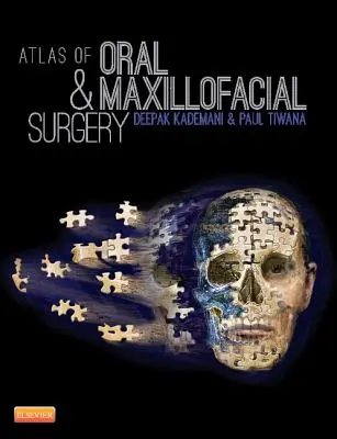 Atlas chirurgii jamy ustnej i szczękowo-twarzowej - Atlas of Oral and Maxillofacial Surgery