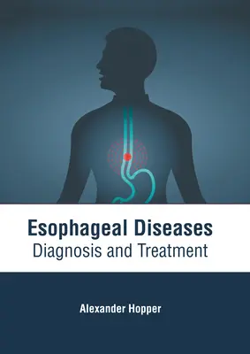 Choroby przełyku: Diagnoza i leczenie - Esophageal Diseases: Diagnosis and Treatment