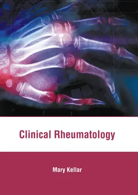 Reumatologia kliniczna - Clinical Rheumatology