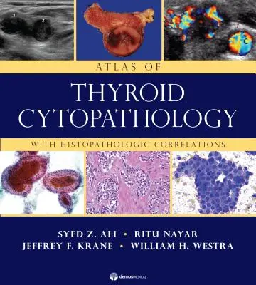 Atlas cytopatologii tarczycy: Z korelacjami histopatologicznymi - Atlas of Thyroid Cytopathology: With Histopathologic Correlations