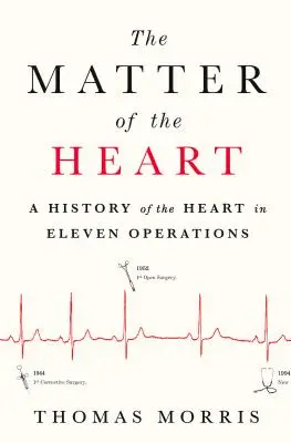 The Matter of the Heart: Historia serca w jedenastu operacjach - The Matter of the Heart: A History of the Heart in Eleven Operations