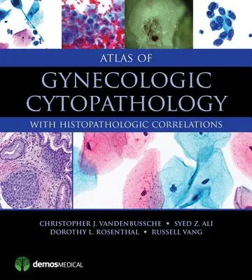 Atlas cytopatologii ginekologicznej: Z korelacjami histopatologicznymi - Atlas of Gynecologic Cytopathology: With Histopathologic Correlations