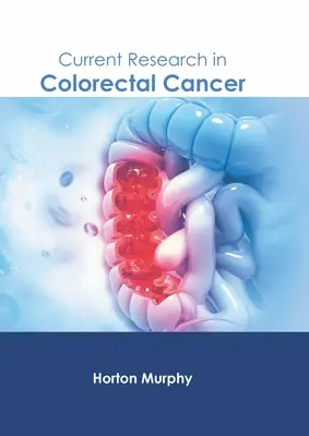 Aktualne badania nad rakiem jelita grubego - Current Research in Colorectal Cancer