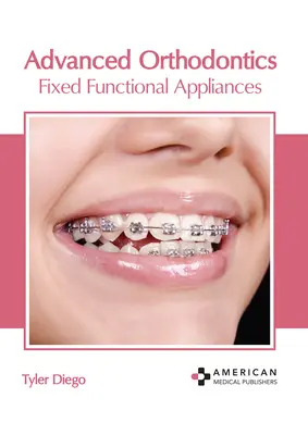 Zaawansowana ortodoncja: Stałe aparaty funkcjonalne - Advanced Orthodontics: Fixed Functional Appliances