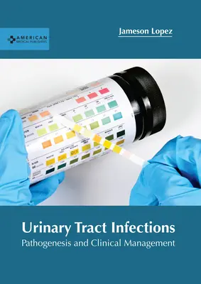 Zakażenia układu moczowego: Patogeneza i postępowanie kliniczne - Urinary Tract Infections: Pathogenesis and Clinical Management