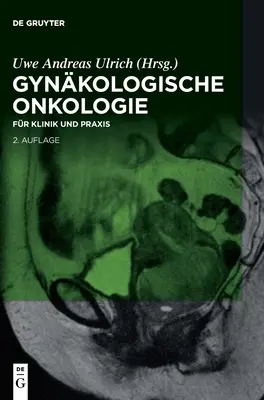 Onkologia ginekologiczna - Gynkologische Onkologie