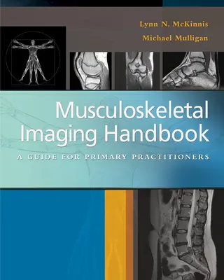 Podręcznik obrazowania układu mięśniowo-szkieletowego: Przewodnik dla lekarzy pierwszego kontaktu - Musculoskeletal Imaging Handbook: A Guide for Primary Practitioners