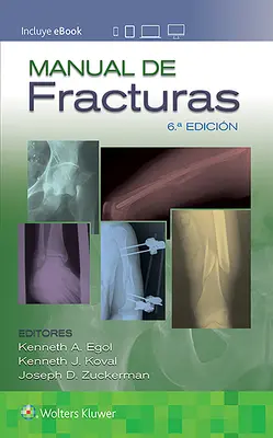 Podręcznik złamań - Manual de Fracturas