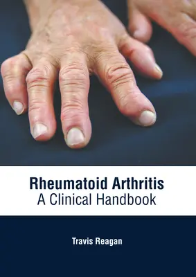 Reumatoidalne zapalenie stawów: Podręcznik kliniczny - Rheumatoid Arthritis: A Clinical Handbook