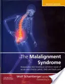 Syndrom nieprawidłowego ułożenia: Diagnoza i leczenie powszechnych bólów miednicy i pleców - The Malalignment Syndrome: Diagnosis and Treatment of Common Pelvic and Back Pain