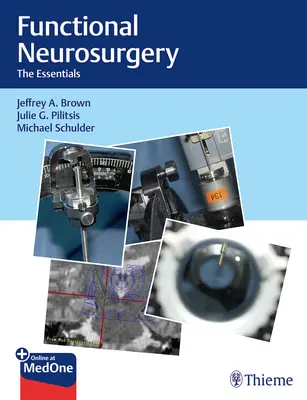 Neurochirurgia funkcjonalna: Podstawy - Functional Neurosurgery: The Essentials