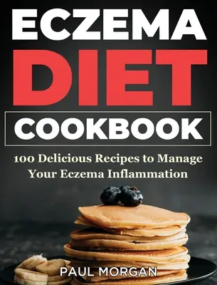 Eczema DIet Cookbook: 100 pysznych przepisów, aby poradzić sobie z zapaleniem egzemy - Eczema DIet Cookbook: 100 Delicious Recipes to Manage your Eczema Inflammation