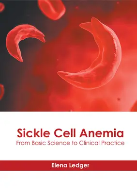 Anemia sierpowata: Od nauk podstawowych do praktyki klinicznej - Sickle Cell Anemia: From Basic Science to Clinical Practice