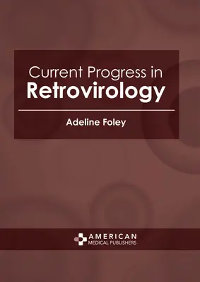 Aktualne postępy w retrowirusologii - Current Progress in Retrovirology