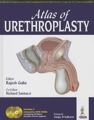 Atlas uretroplastyki - Atlas of Urethroplasty