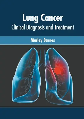 Rak płuc: Diagnostyka kliniczna i leczenie - Lung Cancer: Clinical Diagnosis and Treatment