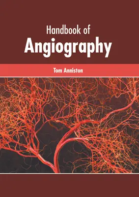 Podręcznik angiografii - Handbook of Angiography