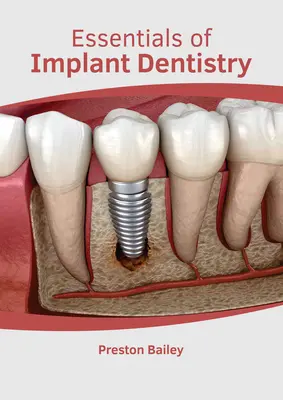 Podstawy stomatologii implantologicznej - Essentials of Implant Dentistry