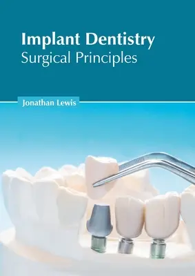 Stomatologia implantologiczna: Zasady chirurgii - Implant Dentistry: Surgical Principles