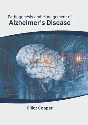 Patogeneza i leczenie choroby Alzheimera - Pathogenesis and Management of Alzheimer's Disease