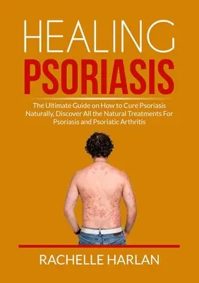 Leczenie łuszczycy: Najlepszy przewodnik po tym, jak naturalnie leczyć łuszczycę, odkryj wszystkie naturalne metody leczenia łuszczycy i łuszczycy - Healing Psoriasis: The Ultimate Guide on How to Cure Psoriasis Naturally, Discover All the Natural Treatments For Psoriasis and Psoriatic