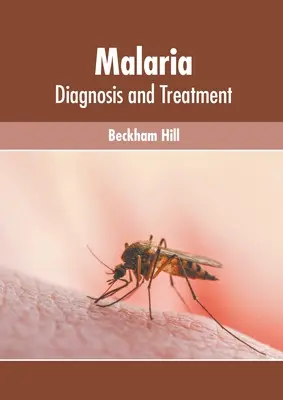 Malaria: diagnoza i leczenie - Malaria: Diagnosis and Treatment