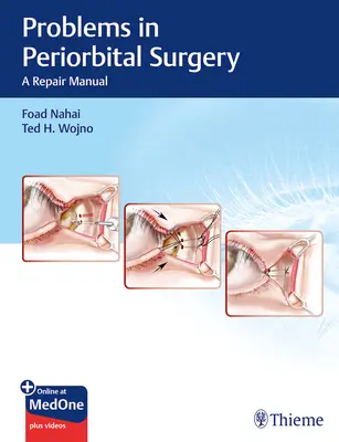 Problemy w chirurgii okołooczodołowej: Podręcznik naprawczy - Problems in Periorbital Surgery: A Repair Manual
